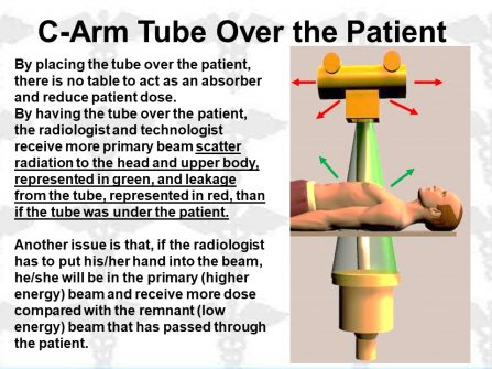 X-Ray C-Arm