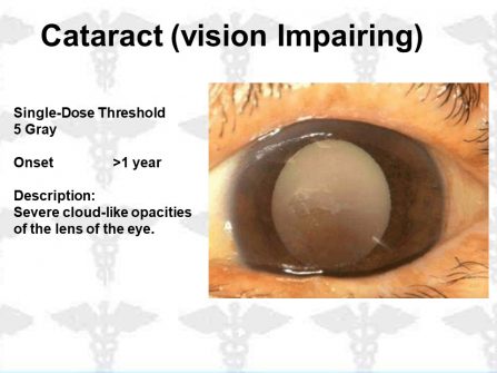 Eye for ASRT Course