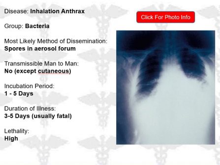 ASRT Chest X-Ray